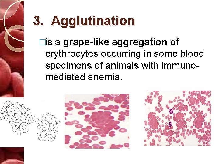3. Agglutination �is a grape-like aggregation of erythrocytes occurring in some blood specimens of