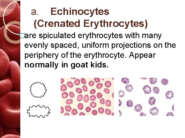 a. Echinocytes (Crenated Erythrocytes) �are spiculated erythrocytes with many evenly spaced, uniform projections on