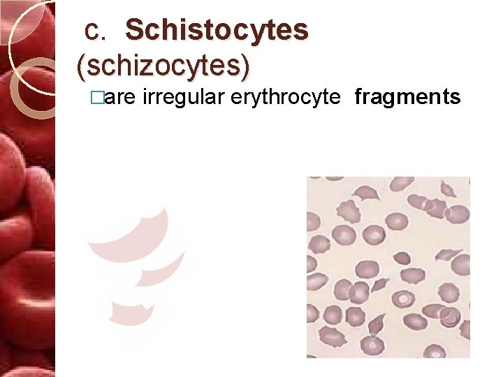 c. Schistocytes (schizocytes) �are irregular erythrocyte fragments 