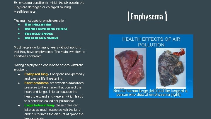 Emphysema condition in which the air sacs in the lungs are damaged or enlarged