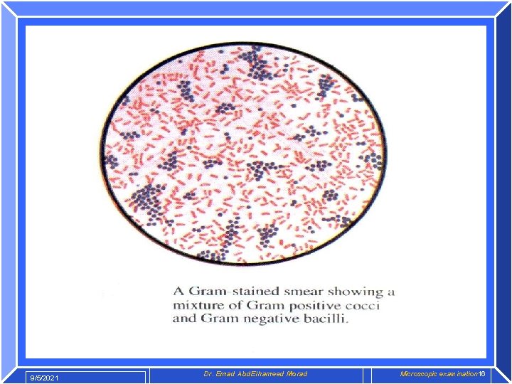 9/5/2021 Dr. Emad Abd. Elhameed Morad Microscopic examination 16 
