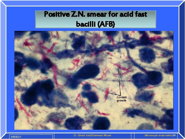 Positive Z. N. smear for acid fast bacilli (AFB) 9/5/2021 Dr. Emad Abd. Elhameed