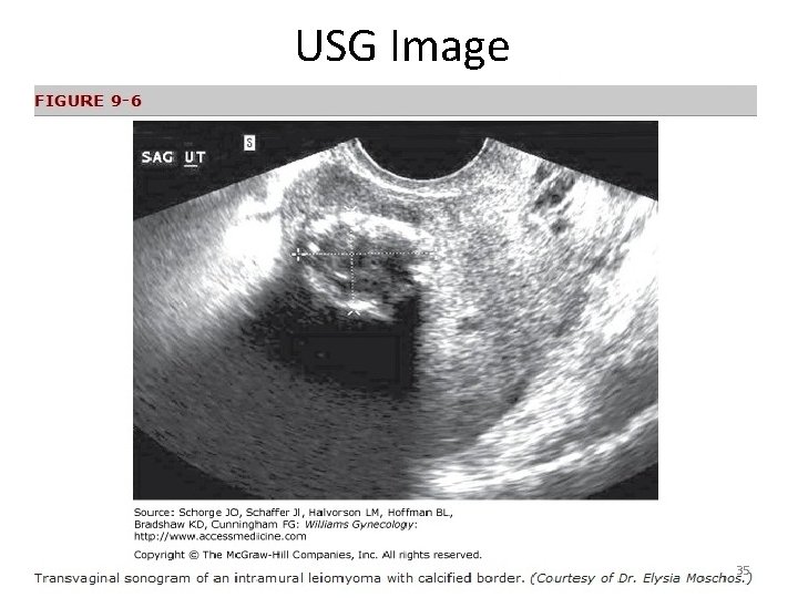 USG Image 35 