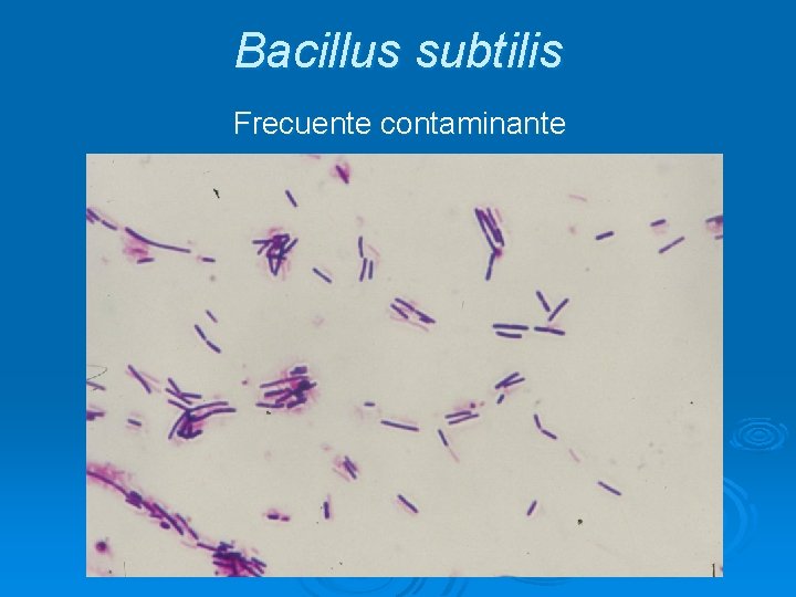 Bacillus subtilis Frecuente contaminante 