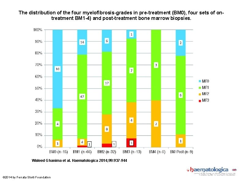 The distribution of the four myelofibrosis-grades in pre-treatment (BM 0), four sets of ontreatment