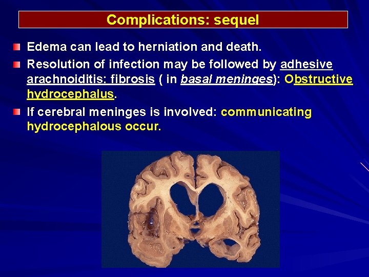 Complications: sequel Edema can lead to herniation and death. Resolution of infection may be