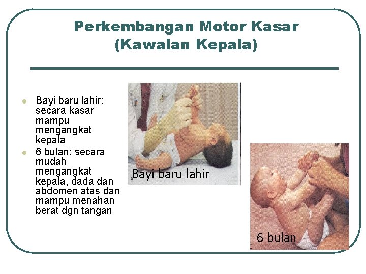 Perkembangan Motor Kasar (Kawalan Kepala) l l Bayi baru lahir: secara kasar mampu mengangkat