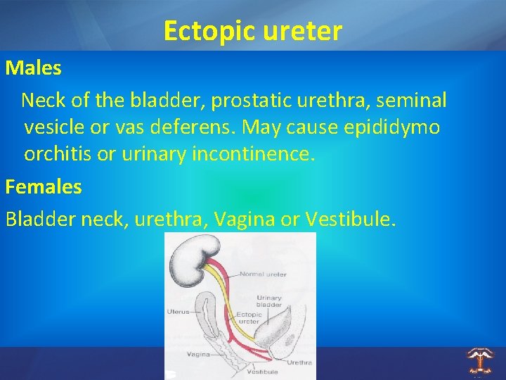 Ectopic ureter Males Neck of the bladder, prostatic urethra, seminal vesicle or vas deferens.