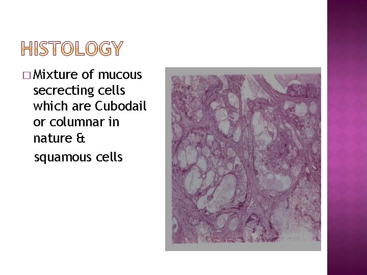� Mixture of mucous secrecting cells which are Cubodail or columnar in nature &