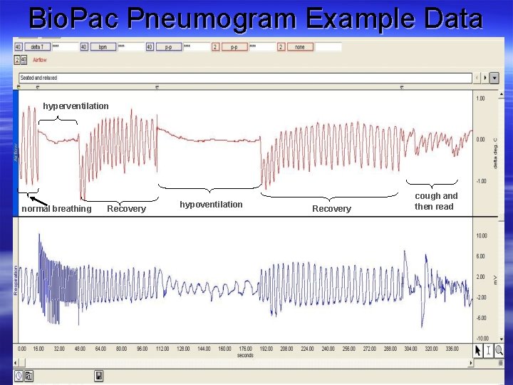 Bio. Pac Pneumogram Example Data hyperventilation normal breathing Recovery hypoventilation Recovery cough and then