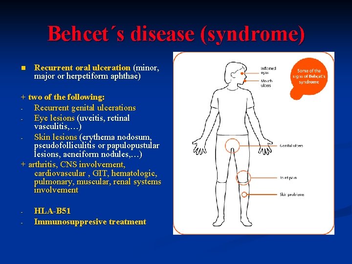 Behcet´s disease (syndrome) n Recurrent oral ulceration (minor, major or herpetiform aphthae) + two