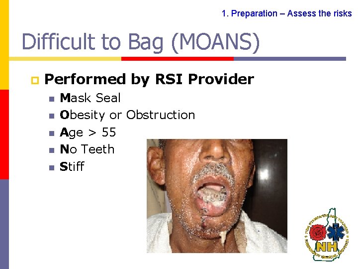 1. Preparation – Assess the risks Difficult to Bag (MOANS) p Performed by RSI