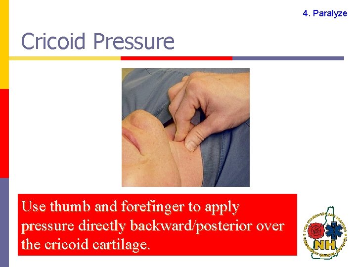 4. Paralyze Cricoid Pressure Use thumb and forefinger to apply pressure directly backward/posterior over