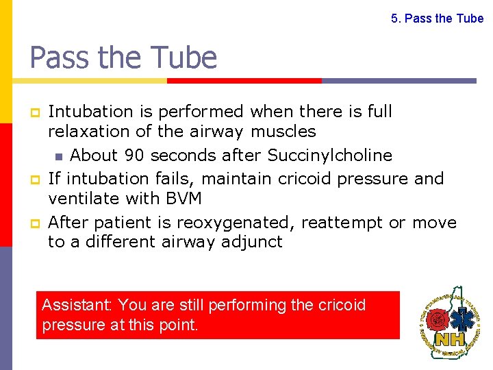 5. Pass the Tube p p p Intubation is performed when there is full