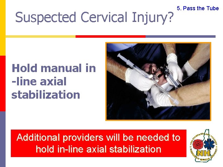 Suspected Cervical Injury? 5. Pass the Tube Hold manual in -line axial stabilization Additional