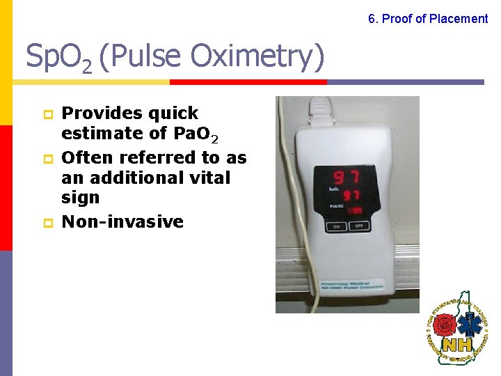 6. Proof of Placement Sp. O 2 (Pulse Oximetry) p p p Provides quick