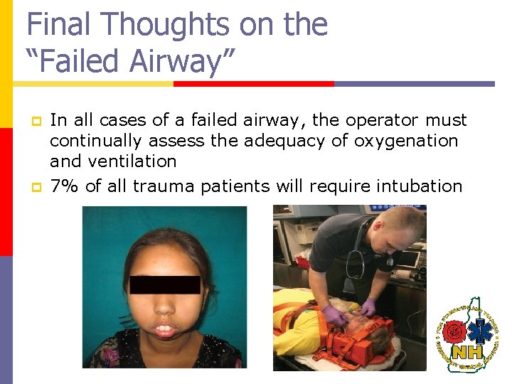 Final Thoughts on the “Failed Airway” p p In all cases of a failed