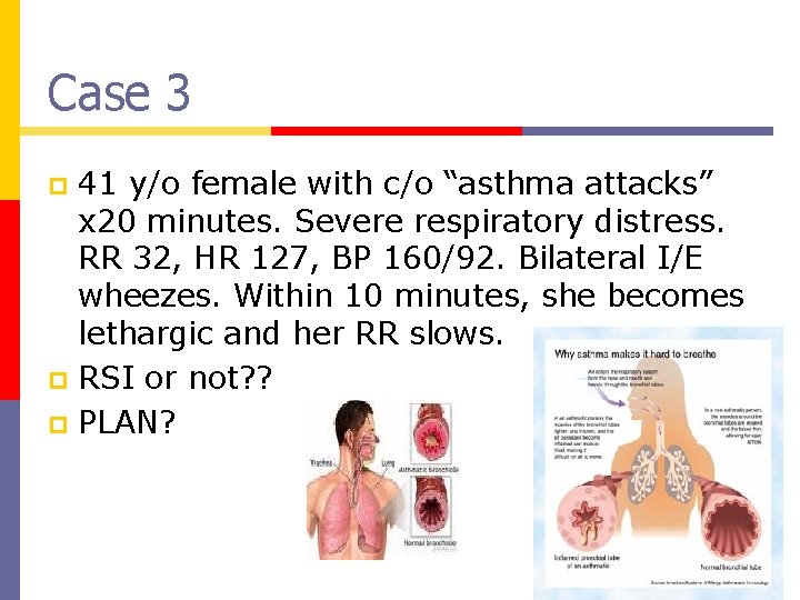 Case 3 41 y/o female with c/o “asthma attacks” x 20 minutes. Severe respiratory