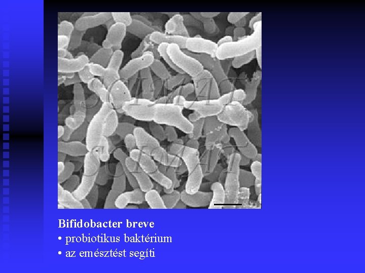Bifidobacter breve • probiotikus baktérium • az emésztést segíti 
