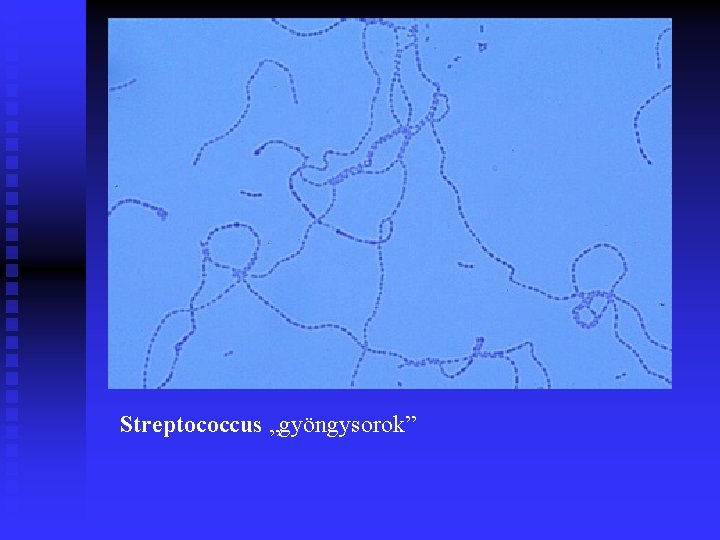 Streptococcus „gyöngysorok” 