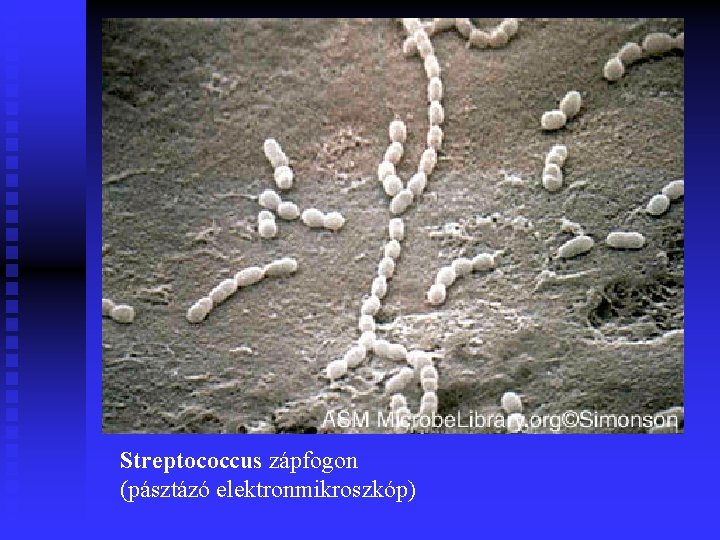 Streptococcus zápfogon (pásztázó elektronmikroszkóp) 