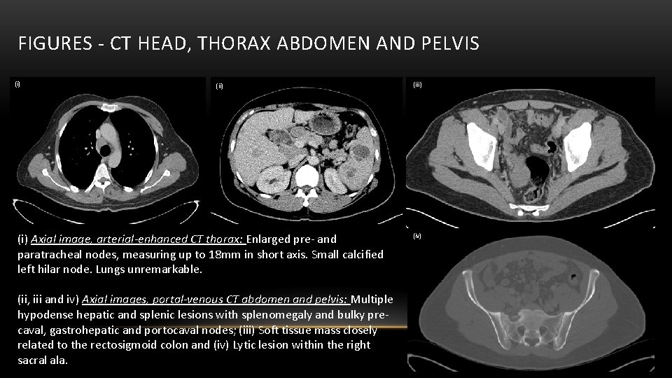 FIGURES - CT HEAD, THORAX ABDOMEN AND PELVIS (i) (i) Axial image, arterial-enhanced CT