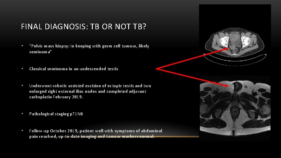 2011 FINAL DIAGNOSIS: TB OR NOT TB? • “Pelvic mass biopsy: In keeping with