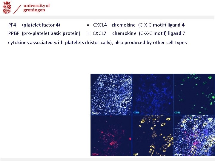 PF 4 (platelet factor 4) PPBP (pro-platelet basic protein) = CXCL 4 chemokine (C-X-C