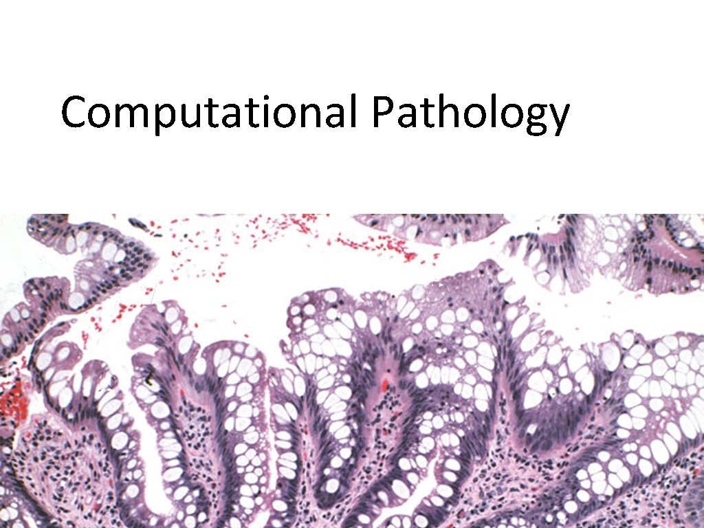 Computational Pathology 