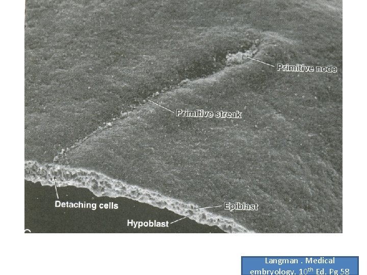 Langman. Medical embryology. 10 th Ed. Pg 58 