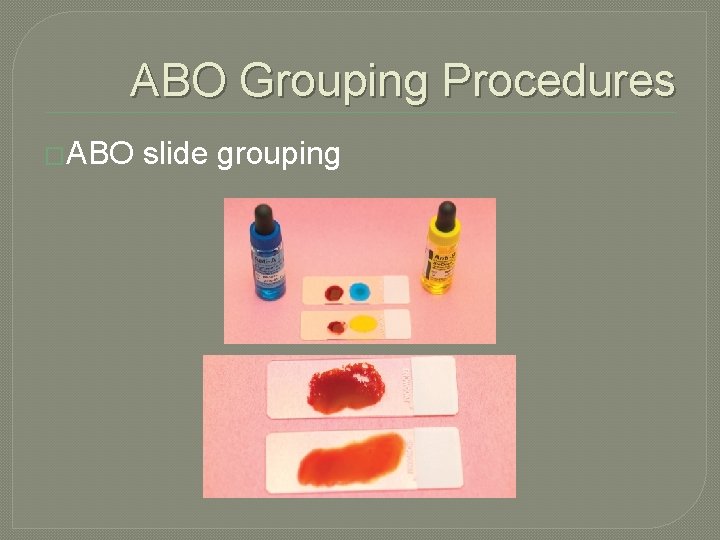 ABO Grouping Procedures �ABO slide grouping 
