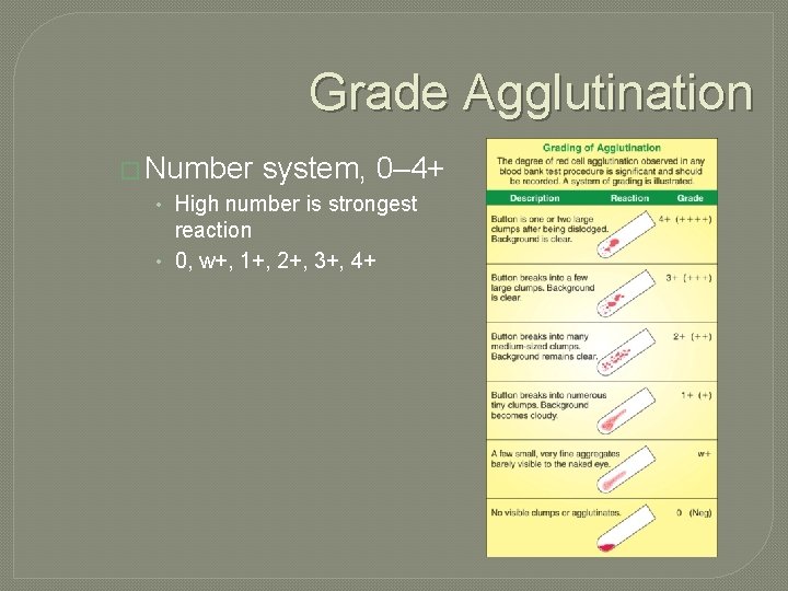 Grade Agglutination � Number system, 0– 4+ • High number is strongest reaction •