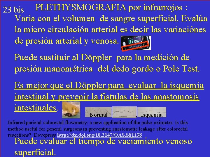 PLETHYSMOGRAFIA por infrarrojos : Varia con el volumen de sangre superficial. Evalúa la micro