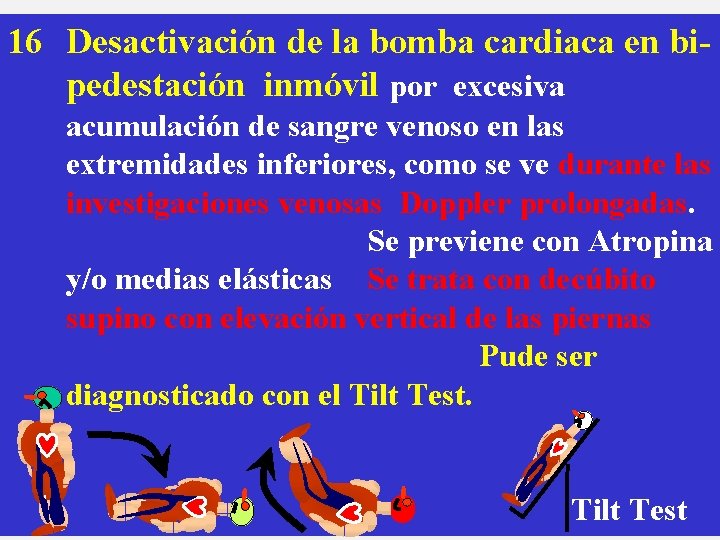 16 Desactivación de la bomba cardiaca en bipedestación inmóvil por excesiva acumulación de sangre