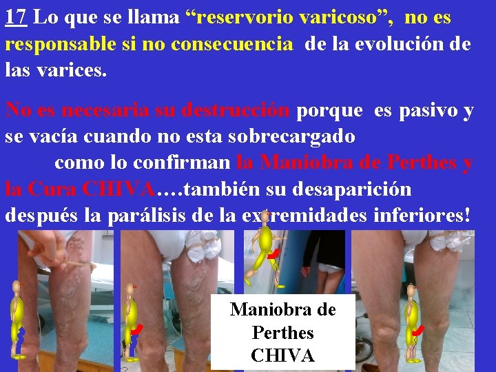 17 Lo que se llama “reservorio varicoso”, no es responsable si no consecuencia de