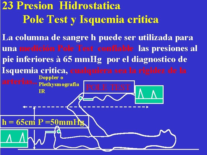 23 Presion Hidrostatica Pole Test y Isquemia critica La columna de sangre h puede