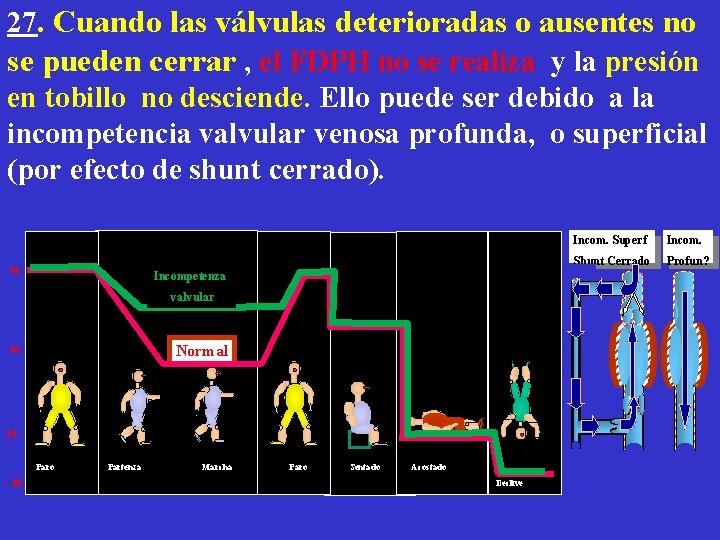 27. Cuando las válvulas deterioradas o ausentes no se pueden cerrar , el FDPH