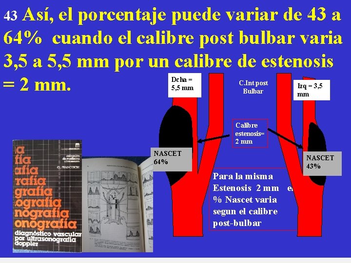 43 Así, el porcentaje puede variar de 43 a 64% cuando el calibre post