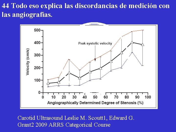 44 Todo eso explica las discordancias de medición con las angiografías. Carotid Ultrasound Leslie
