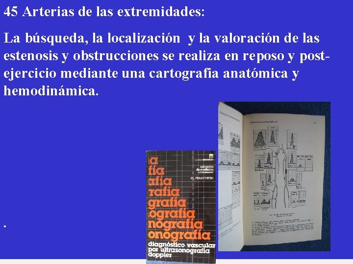 45 Arterias de las extremidades: La búsqueda, la localización y la valoración de las