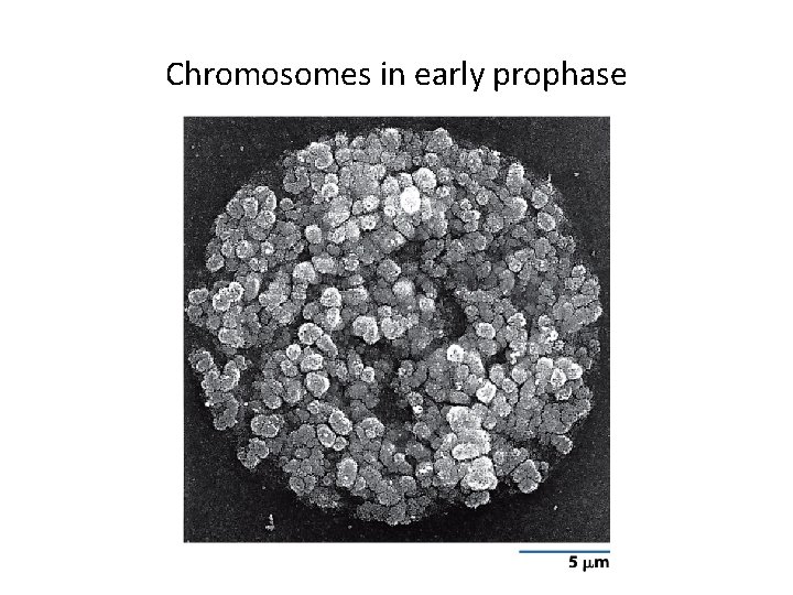 Chromosomes in early prophase 