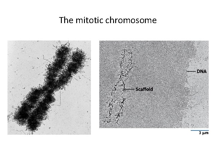 The mitotic chromosome 