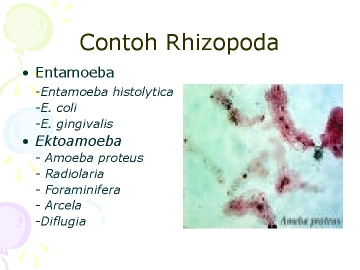 Contoh Rhizopoda • Entamoeba -Entamoeba histolytica -E. coli -E. gingivalis • Ektoamoeba - Amoeba