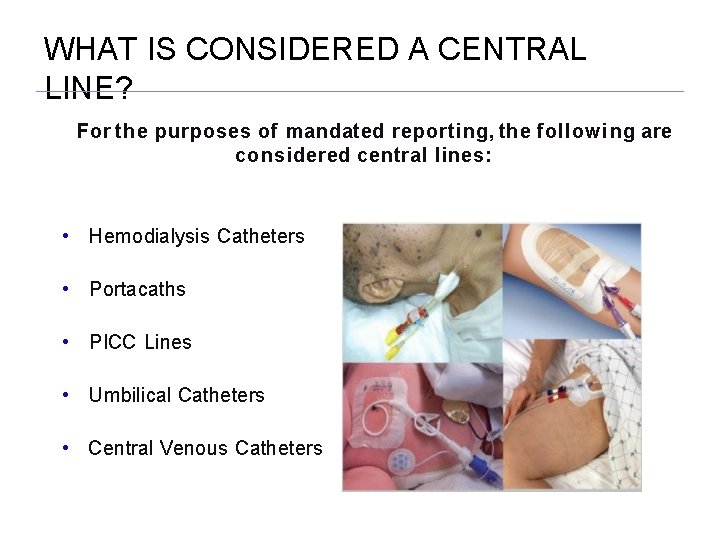 WHAT IS CONSIDERED A CENTRAL LINE? For the purposes of mandated reporting, the followi