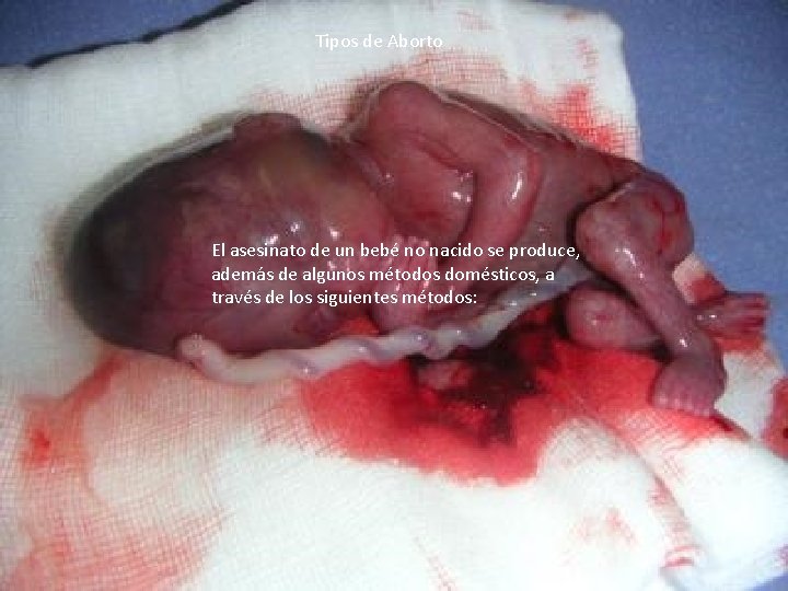 Tipos de Aborto El asesinato de un bebé no nacido se produce, además de