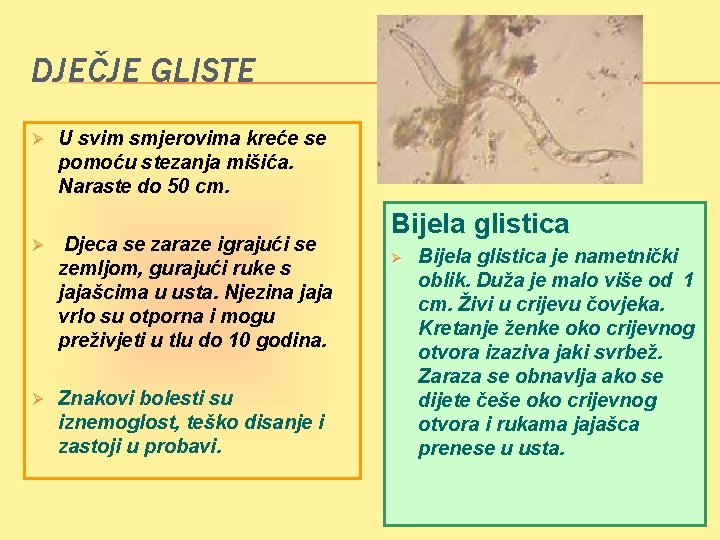 DJEČJE GLISTE Ø U svim smjerovima kreće se pomoću stezanja mišića. Naraste do 50