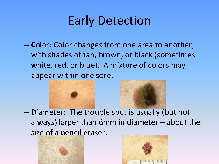 Early Detection – Color: Color changes from one area to another, with shades of