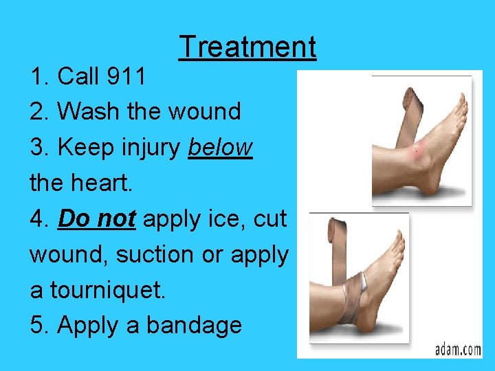 Treatment 1. Call 911 2. Wash the wound 3. Keep injury below the heart.