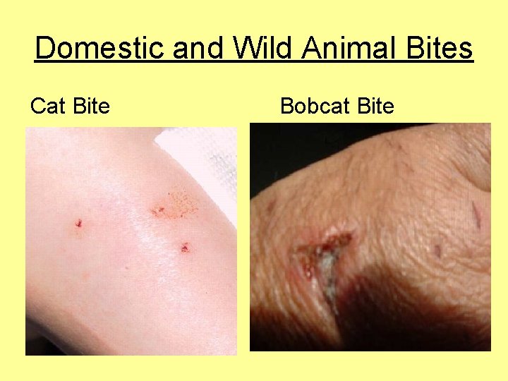 Domestic and Wild Animal Bites Cat Bite Bobcat Bite 