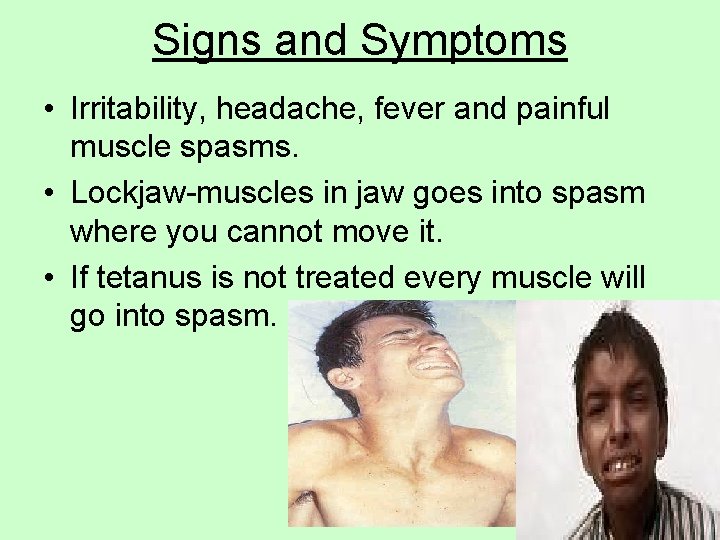 Signs and Symptoms • Irritability, headache, fever and painful muscle spasms. • Lockjaw-muscles in